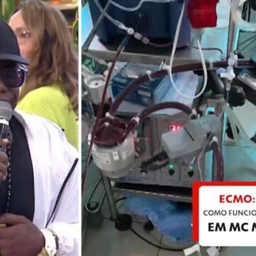 MC Marcinho usa terapia conhecida como ECMO, espécie de pulmão MC Marcinho usa terapia conhecida como ECMO, espécie de pulmão artificial; entenda como funciona