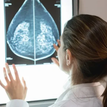 HER2 baixo: a descoberta que está mudando o tratamento do câncer de mama