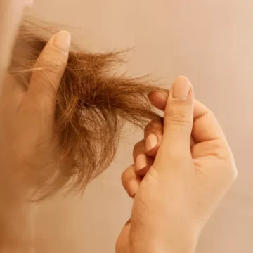 Mounjaro causa queda de cabelo? Saiba o que fazer