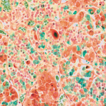 Zoom: conheça a hipófise, glândula que comanda hormônios de todo o corpo