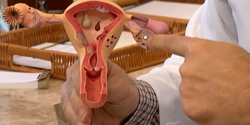 Aberta chamada pública para pesquisas sobre endometriose Aberta chamada pública para pesquisas sobre endometriose