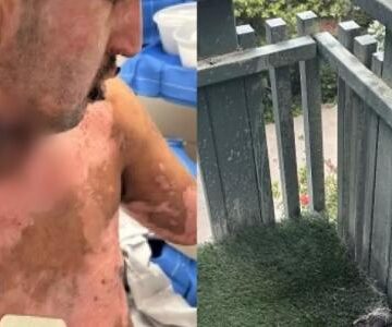 Homem processa Amazon após explosão de lareira