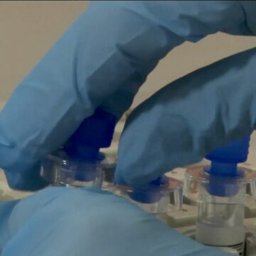 Teste genético que identifica risco hereditário de câncer de mama chega ao SUS