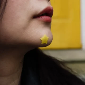 Adesivo para espinha funciona? Saiba quando vale a pena usar