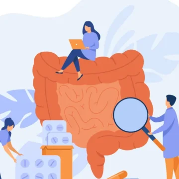 Câncer colorretal: o que muda com o novo teste incluído Câncer colorretal: o que muda com o novo teste incluído no SUS