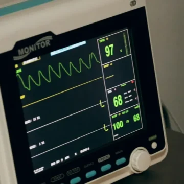 Síndrome de Lázaro? Entenda o que aconteceu com bebê dado como morto