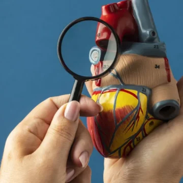 O que é cardiomiopatia? Conheça tipos, sintomas e tratamentos