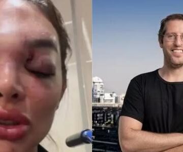 Vítima de agressão cobra punição e critica autoridades: ?É revoltante?