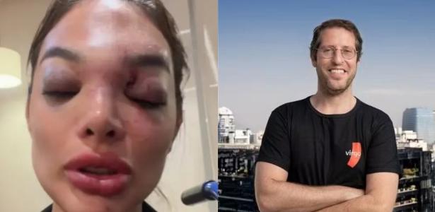 Vítima de agressão cobra punição e critica autoridades: ?É revoltante? Vítima de agressão cobra punição e critica autoridades: ?É revoltante?