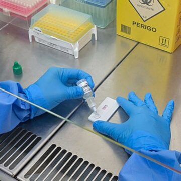 Anvisa atualiza regras sobre controle de qualidade em laboratórios