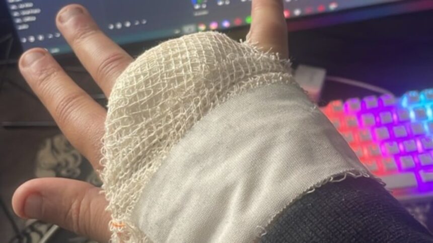 Streamer Lodk perde dedo no Rock in Rio e diz se arrepender