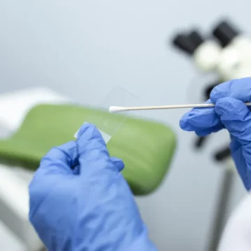 Planos de saúde terão de cobrir DIU hormonal para mulheres com endometriose: confira regras