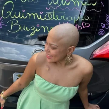 Aos 27 anos, passei de menina bronzeada e feliz a paciente oncológica